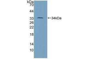Detection of Recombinant TP53, Mouse using Polyclonal Antibody to Tumor Protein p53 (P53) (p53 antibody  (AA 134-387))