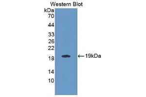 Western Blotting (WB) image for anti-Interleukin 25 (IL25) (AA 33-169) antibody (ABIN1868646) (IL-25 antibody  (AA 33-169))