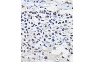 Immunohistochemistry (IHC) image for anti-Heterogeneous Nuclear Ribonucleoprotein U (Scaffold Attachment Factor A) (HNRNPU) (AA 608-825) antibody (ABIN1680323)