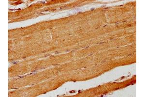 IHC image of ABIN7157686 diluted at 1:200 and staining in paraffin-embedded human skeletal muscle tissue performed on a Leica BondTM system. (ANKRD15 antibody  (AA 66-255))