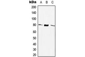Western blot analysis of SSTR2 expression in THP1 (A), NIH3T3 (B), H9C2 (C) whole cell lysates. (SSTR2 antibody  (Center))
