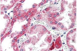 Human Kidney (formalin-fixed, paraffin-embedded) stained with ATG7 antibody ABIN307175 at 5 ug/ml followed by biotinylated goat anti-rabbit IgG secondary antibody ABIN481713, alkaline phosphatase-streptavidin and chromogen.