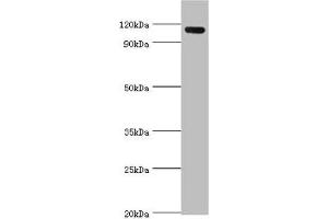 Western blot All lanes: Angiomotin antibody at 2 μg/mL + 293T whole cell lysate Secondary Goat polyclonal to rabbit IgG at 1/10000 dilution Predicted band size: 119, 73 kDa Observed band size: 119 kDa (Angiomotin antibody  (AA 1-300))