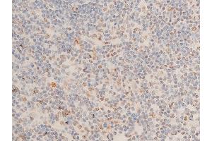 ABIN6267073 at 1/100 staining human appendiceal tissue sections by IHC-P. (CHEK1 antibody  (pSer280))