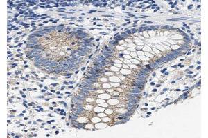 ABIN6267481 at 1/100 staining human colon tissue sections by IHC-P. (NOS2 antibody  (pTyr151))