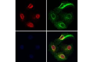 ABIN7093882 and ABIN7097925 staining Hela cells by IF/ICC.