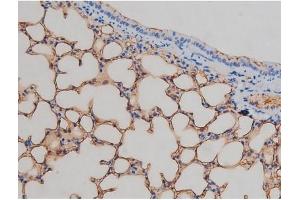ABIN6267337 at 1/200 staining Mouse lung tissue sections by IHC-P. (IGF1R antibody  (pTyr1161))