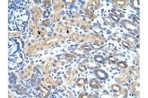 U1SNRNPBP antibody was used for immunohistochemistry at a concentration of 4-8 ug/ml to stain Epithelial cells of renal tubule (arrows) in Human Kidney.