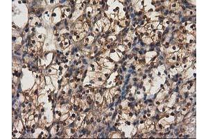 Immunohistochemistry (IHC) image for anti-Destrin (Actin Depolymerizing Factor) (DSTN) antibody (ABIN1497910) (Destrin antibody)