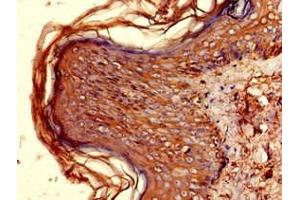 Immunohistochemistry of paraffin-embedded human skin tissue using ABIN7155597 at dilution of 1:100 (HLA-DQB1 antibody  (AA 128-175))