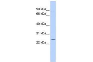 Image no. 1 for anti-Proteasome (Prosome, Macropain) Subunit, beta Type, 5 (PSMB5) (AA 72-121) antibody (ABIN6744083) (PSMB5 antibody  (AA 72-121))