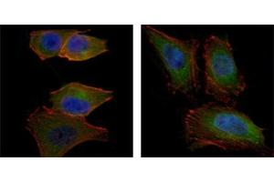 Immunofluorescence analysis of PANC-1 (left) and Hela (right) cells using AKT2 mouse mAb (green). (AKT2 antibody)