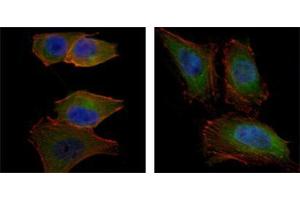 Immunofluorescence analysis of PANC-1 (left) and Hela (right) cells using AKT2 mouse mAb (green).