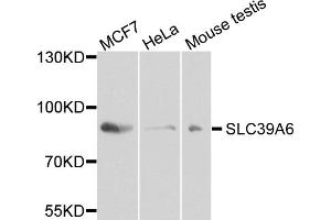Western blot analysis of extracts of various cell lines, using SLC39A6 antibody (ABIN5972625) at 1/1000 dilution. (SLC39A6 antibody)