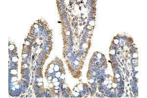 KARS antibody was used for immunohistochemistry at a concentration of 4-8 ug/ml to stain Epithelial cells of intestinal villus (arrows) in Human Intestine. (KARS antibody  (C-Term))