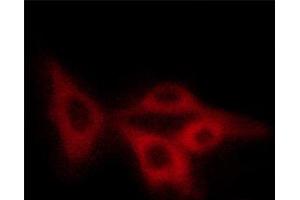 ABIN6267404 staining COS7 cells by ICC/IF. (Stathmin 1 antibody  (pSer15))