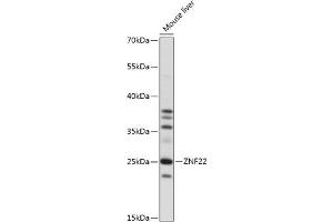Western blot analysis of extracts of mouse liver, using ZNF22 antibody (ABIN7271468) at 1:1000 dilution. (Zinc Finger Protein 22 antibody  (AA 1-224))