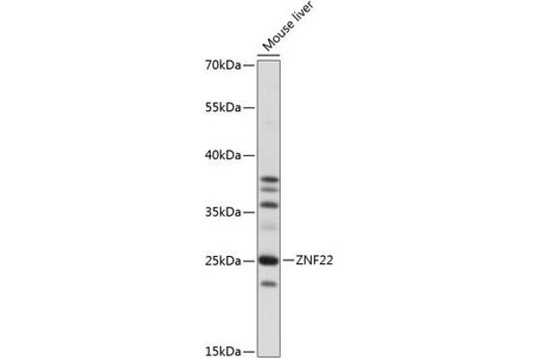 Zinc Finger Protein 22 anticorps  (AA 1-224)