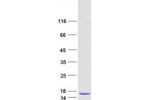 Validation with Western Blot (SRP9 Protein (Transcript Variant 2) (Myc-DYKDDDDK Tag))