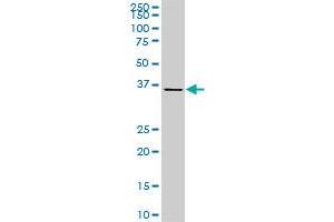 CDX4 monoclonal antibody (M06), clone 3F3. (CDX4 antibody  (AA 71-170))