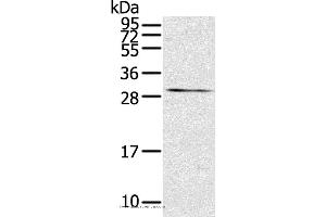 Western blot analysis of Mouse kidney tissue, using TNFSF15 Polyclonal Antibody at dilution of 1:600