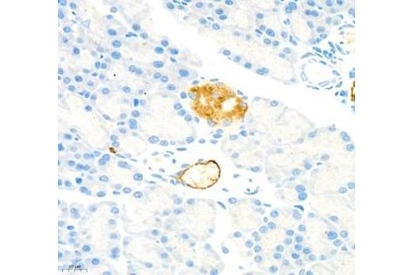 MADCAM1 antibody