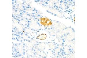 Immunohistochemistry of paraffin embedded rat pancreatic using MADCAM1 (ABIN7074695) at dilution of 1:1800 (400x lens) (MADCAM1 antibody)