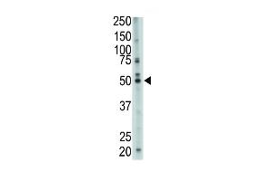 The anti-FDFT1 Pab (ABIN389051 and ABIN2839260) is used in Western blot to detect FDFT1 in mouse cerebellum tissue lysate. (FDFT1 antibody  (N-Term))