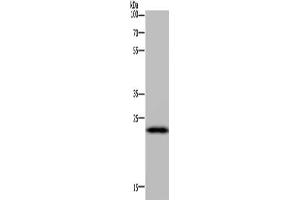 Gel: 10 % SDS-PAGE, Lysate: 40 μg, Lane: Mouse liver tissue, Primary antibody: ABIN7130524(PAEP Antibody) at dilution 1/300, Secondary antibody: Goat anti rabbit IgG at 1/8000 dilution, Exposure time: 5 minutes