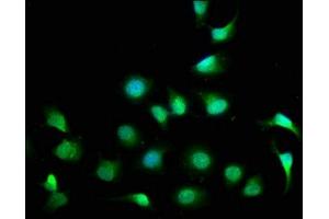 Immunofluorescence staining of A549 cells with ABIN7148527 at 1:100, counter-stained with DAPI. (CPNE7 antibody  (AA 254-393))