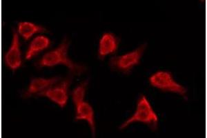ABIN6276173 staining Hela by IF/ICC. (OR5M9 antibody  (Internal Region))