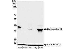 Western Blotting (WB) image for anti-Keratin 19 (KRT19) antibody (ABIN7449419) (Cytokeratin 19 antibody)