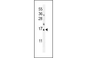 HRK antibody  (AA 15-50)