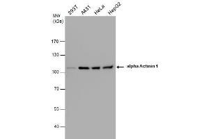WB Image alpha Actinin 1 antibody detects alpha Actinin 1 protein by western blot analysis.