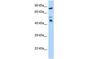 Image no. 1 for anti-Testis Derived Transcript (3 LIM Domains) (TES) (AA 203-252) antibody (ABIN6748070) (TES antibody  (AA 203-252))