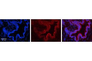 PIGF antibody - N-terminal region          Formalin Fixed Paraffin Embedded Tissue:  Human Bronchial Epithelial Tissue    Observed Staining:  Cytoplasm in Human Bronchial Epithelial Tissue   Primary Antibody Concentration:  1:100    Secondary Antibody:  Donkey anti-Rabbit-Cy3    Secondary Antibody Concentration:  1:200    Magnification:  20X    Exposure Time:  0. (PIGF antibody  (N-Term))