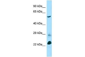 Host: Rabbit Target Name: Btbd3 Sample Type: Mouse Lung lysates Antibody Dilution: 1. (BTBD3 antibody  (C-Term))