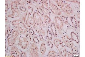 Formalin-fixed and paraffin embedded human kidney tissue labeled with Anti-THEMIS Polyclonal Antibody, Unconjugated 1:400 followed by conjugation to the secondary antibody and DAB staining (THEMIS antibody  (AA 301-400))