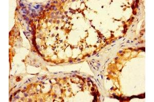 Immunohistochemistry of paraffin-embedded human testis tissue using ABIN7173195 at dilution of 1:100 (TMEM27 antibody  (AA 206-265))