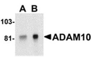 Image no. 1 for anti-ADAM Metallopeptidase Domain 10 (ADAM10) (AA 732-748) antibody (ABIN319033) (ADAM10 antibody  (AA 732-748))