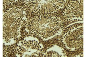 ABIN6273497 at 1/100 staining Mouse testis tissue by IHC-P. (SIVA1 antibody  (Internal Region))