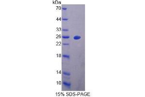 SDS-PAGE of Protein Standard from the Kit  (Highly purified E. (Vitamin D-Binding Protein ELISA Kit)