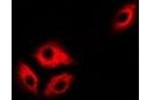 Immunofluorescent analysis of ASL staining in Hela cells. (ASL antibody)