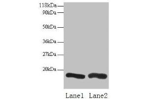 Western blot All lanes: CHMP2A antibody at 2 μg/mL Lane 1: EC109 whole cell lysate Lane 2: 293T whole cell lysate Secondary Goat polyclonal to rabbit IgG at 1/15000 dilution Predicted band size: 26 kDa Observed band size: 16 kDa