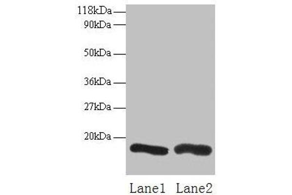 CHMP2A anticorps  (AA 1-222)