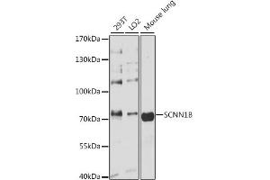 Western blot analysis of extracts of various cell lines, using SCNN1B antibody (ABIN3022509, ABIN3022510, ABIN1513502 and ABIN6218866) at 1:3000 dilution. (SCNN1B antibody  (AA 406-640))
