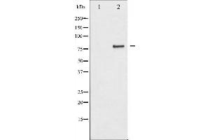Western blot analysis of IKK-alpha expression in EGF treated 293 whole cell lysates,The lane on the left is treated with the antigen-specific peptide.