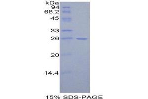SDS-PAGE (SDS) image for Cardiac Troponin I (TNNI3) (AA 1-211) protein (His tag) (ABIN1081045)