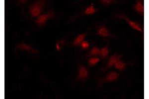 ABIN6267647 staining HT29 by IF/ICC. (IRF3 antibody  (pSer386))
