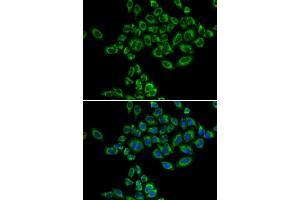 Immunofluorescence analysis of HeLa cells using SRPK1 antibody (ABIN5973465). (SRPK1 antibody)
